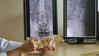 Doctor pointing to lumbar spine model with x-rays in the background.